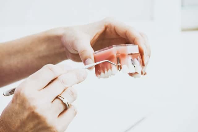 Dentures and Dental Crowns in Sand Springs