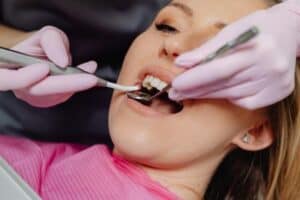 Remedies for Canker Sores and Irritated Gums