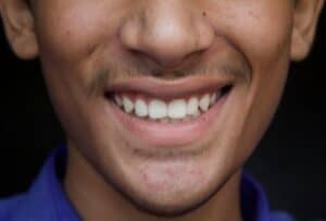 Tips for a Healthy Smile 1 - Dentistry For You | Sand Springs Dentist | Sand Springs, OK Tips for a Healthy Smile